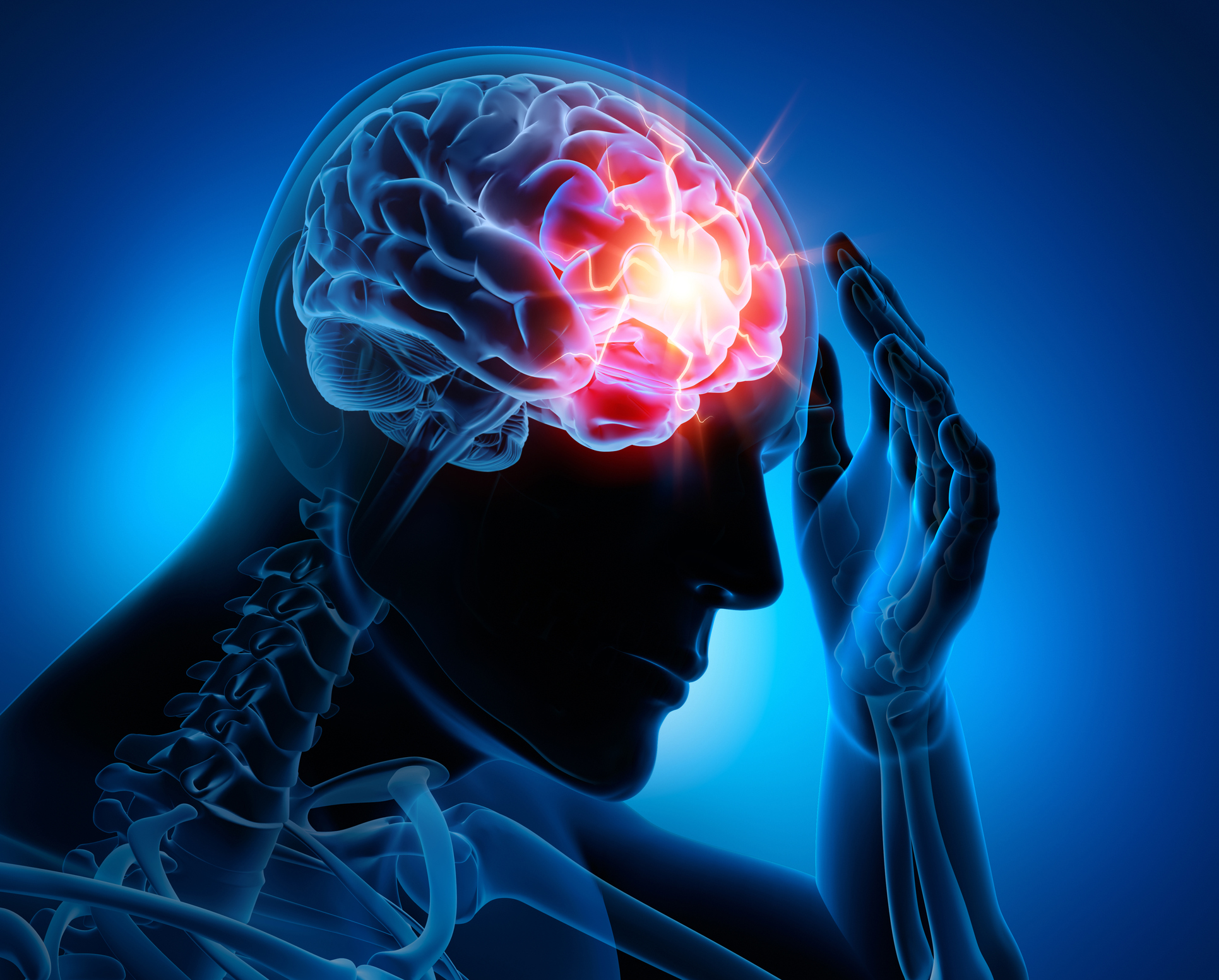 Delayed Concussion Symptoms: What You Need to Know 