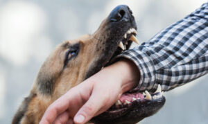How Darrell Cochran Personal Injury Lawyer Can Help After a Dog Bite in Seattle, WA