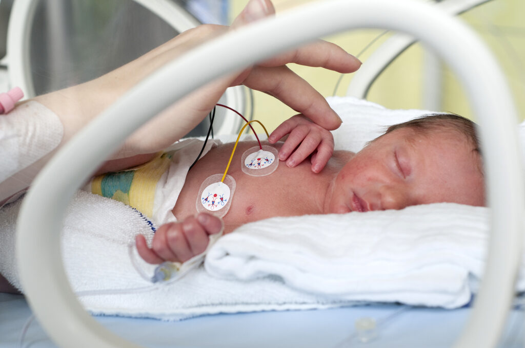 a new born in an incubator with birth injuries
